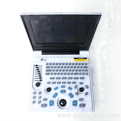 Silver Gradient Liver Ultrasound Diagnostic Equipment